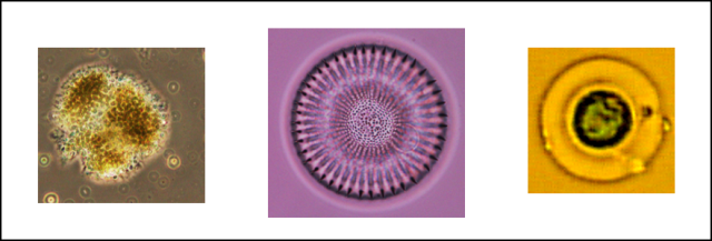 Blue-green algae, Diatom Stephanodiscus subtransylvanicus, Coccoid green algae 