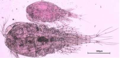 An xray like image of a non-native female Thermocyclops Crassus found in the Great Lakes