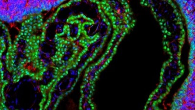 Image of the brain barriers in the developing rat, which are affected by thyroid disruption. Blue staining highlights cell nuclei, green tight cell junctions, and red endothelial cells of blood vessel